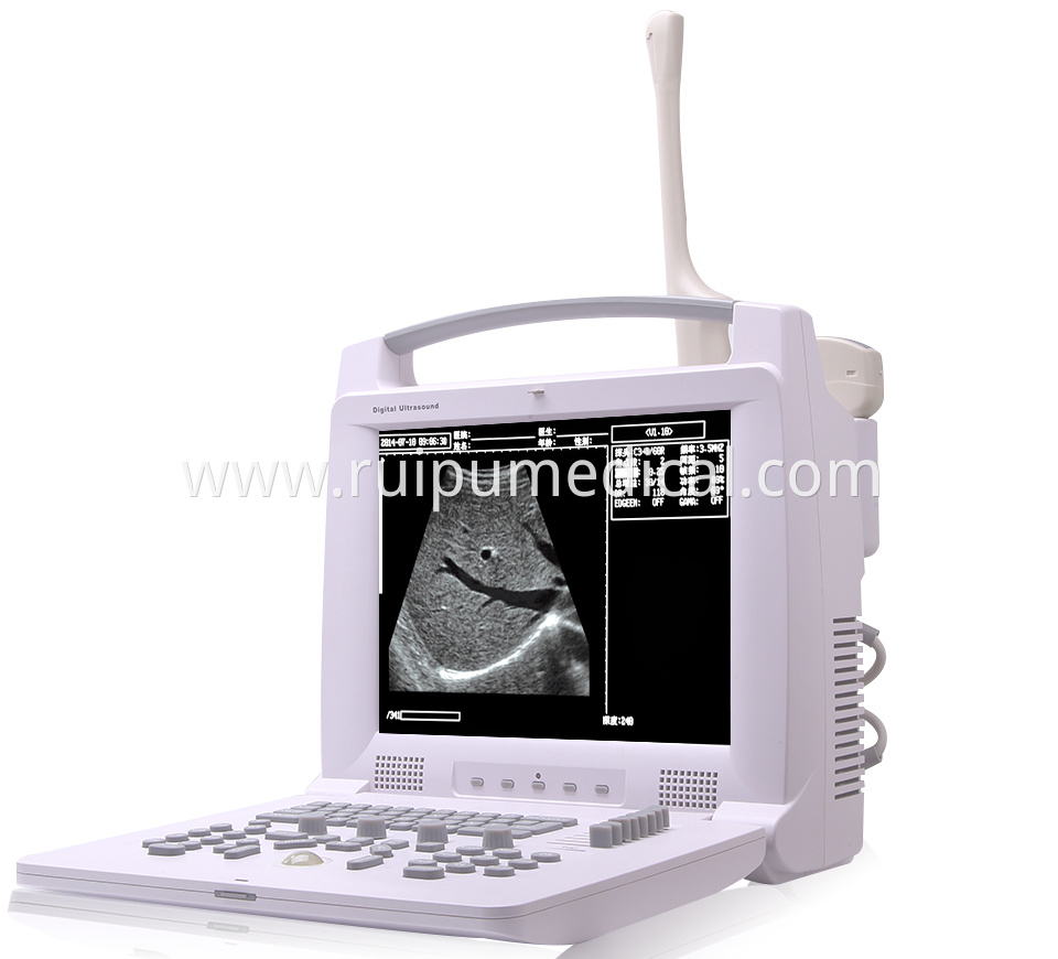 Pl 3018i Full Digital Portable Ultrasound Scanner 18